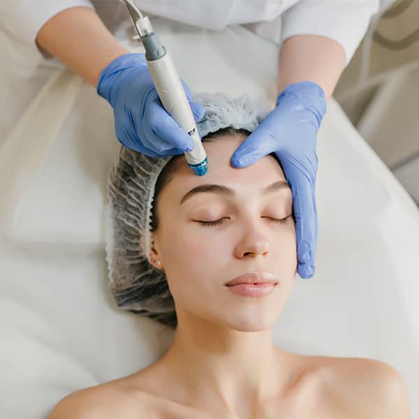 Facial 3 Microdermoabrasión